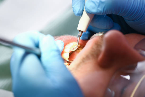 Best Mobile Emergency Dentist in Vandenberg Af, CA
