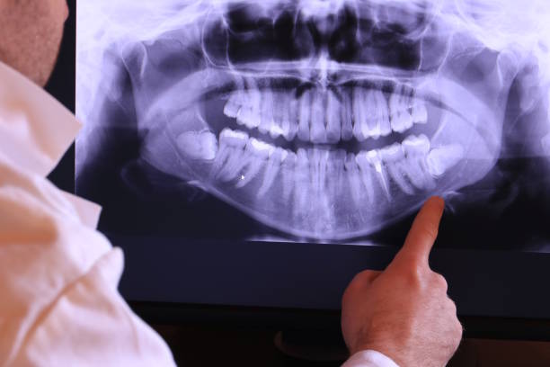 Best Weekend Emergency Dentist in Vandenberg Af, CA